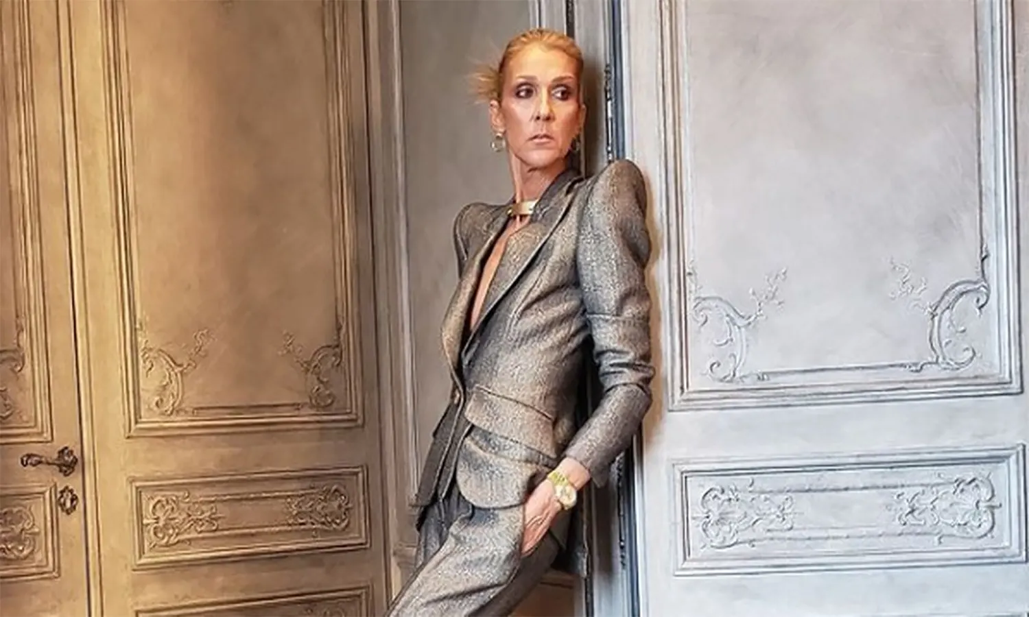 Apa itu Stiff-person Syndrome? Penyakit Langka yang Diderita Celine Dion
